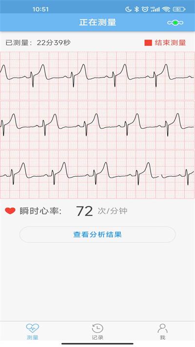 数维康心电app下载,数维康心电,健康app
